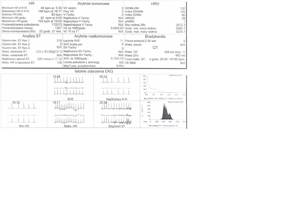 holter.png